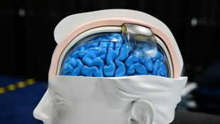 "On est déjà dans la science-fiction": la discrète révolution des neurotechnologies