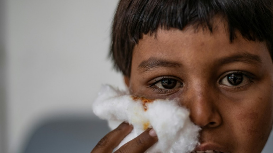 La desnutrici&oacute;n infantil en el noreste de Siria aumenta un 150%